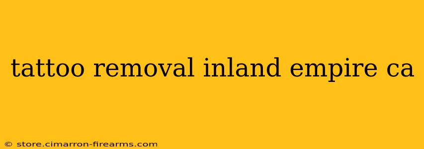 tattoo removal inland empire ca